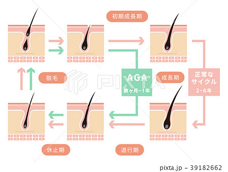 毛髪・ヘアサイクル/正常なサイクルとAGAの比較イラスト 39182662