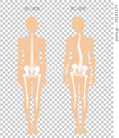 身体の歪み比較 女性 39193277