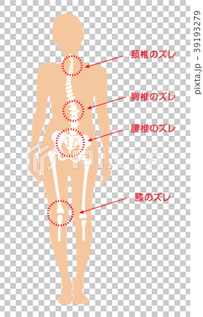 身体の歪み_女性 39193279
