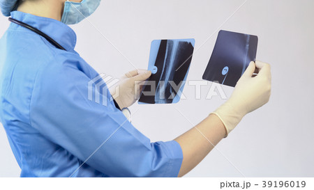Doctor analyzing injured bones x-ray, making 39196019