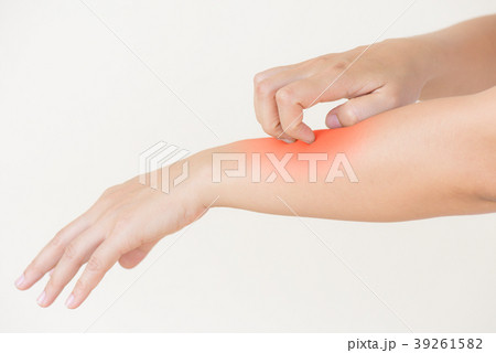 woman hand scratch the itch by hand at home.  woman hand scratch the itch by hand at home.  39261582