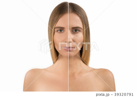 Anti-aging, woman with problem and clean skin 39320791