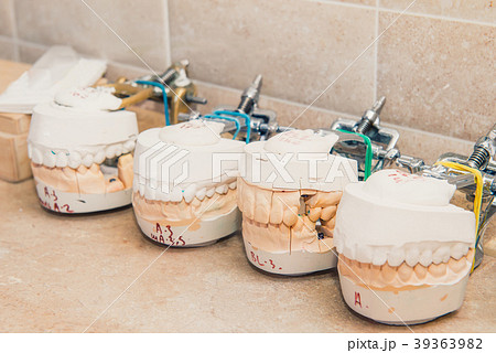 Close up few dental gypsum models, Teeth molds Close up few dental gypsum models, Teeth molds 39363982