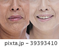 鼻周辺のビフォーアフタービューティーイメージ 39393410