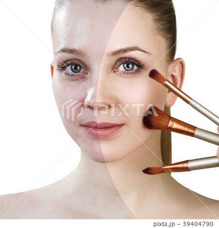 Young girl with brushes before and after treatment 39404790