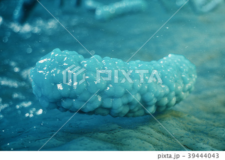 Viral hepatitis infection causing chronic liver Viral hepatitis infection causing chronic liver 39444043