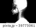 レントゲン横向き 39773061