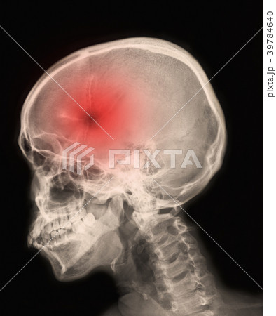 skull scan skull scan 39784640