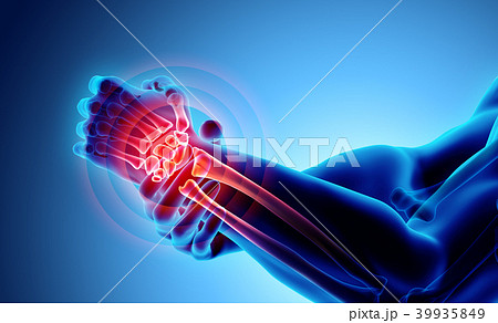 Wrist painful - skeleton x-ray. 39935849