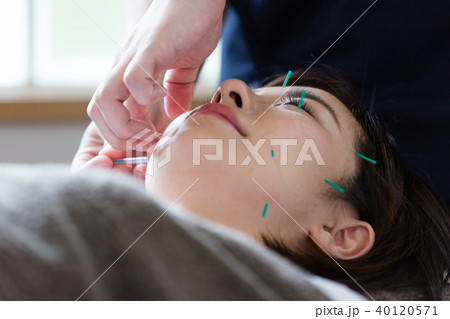美容鍼灸（撮影協力：わぼく -和穆- 二子玉川） 40120571