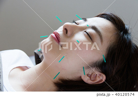 美容鍼灸(撮影協力:わぼく -和穆- 二子玉川) 美容鍼灸(撮影協力:わぼく -和穆- 二子玉川) 40120574