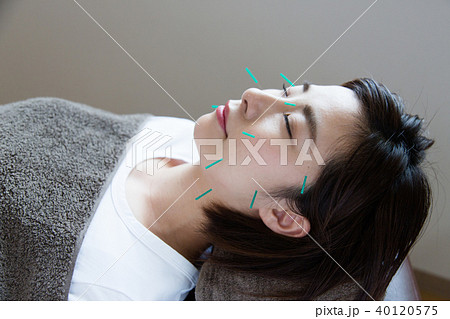 美容鍼灸(撮影協力:わぼく -和穆- 二子玉川) 美容鍼灸(撮影協力:わぼく -和穆- 二子玉川) 40120575