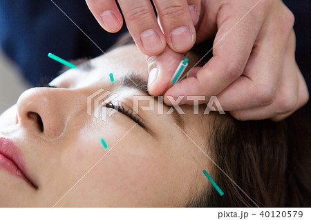 美容鍼灸（撮影協力：わぼく -和穆- 二子玉川） 40120579