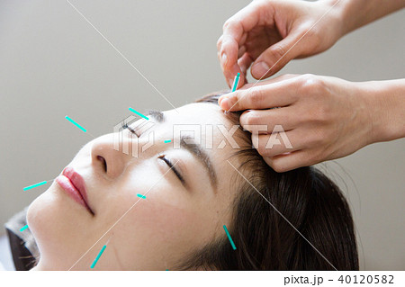 美容鍼灸（撮影協力：わぼく -和穆- 二子玉川） 40120582