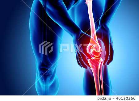 Knee painful - skeleton x-ray. 40130266