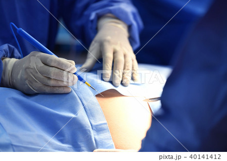 Team surgeon at work on operating room 40141412