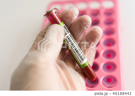 血液検査 40188442