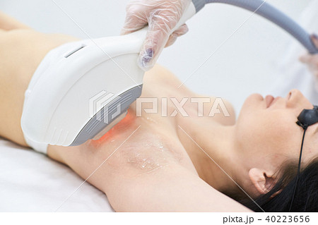 Laser hair removal. Medical procedure.  40223656