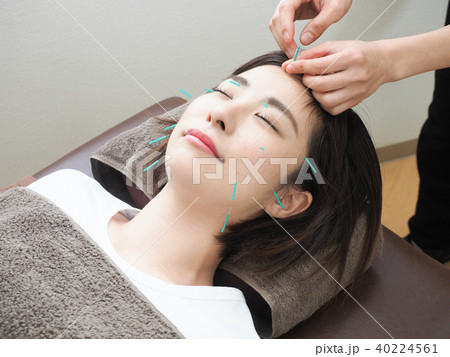 美容鍼灸をする女性 (撮影協力 わぼく) 美容鍼灸をする女性 (撮影協力 わぼく) 40224561