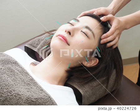 美容鍼灸をする女性 (撮影協力 わぼく) 40224726