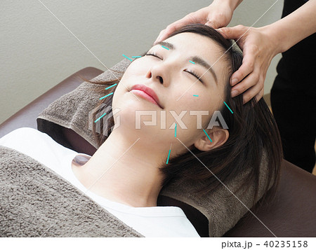 美容鍼灸をする女性 (撮影協力 わぼく) 美容鍼灸をする女性 (撮影協力 わぼく) 40235158