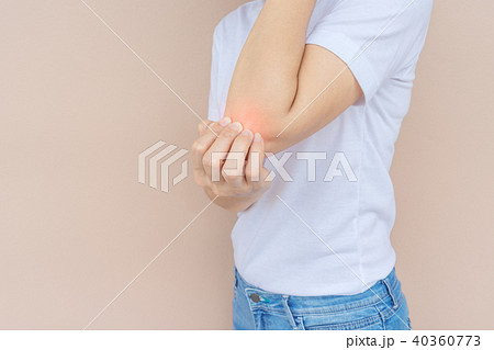 Woman scratching her elbow. 40360773