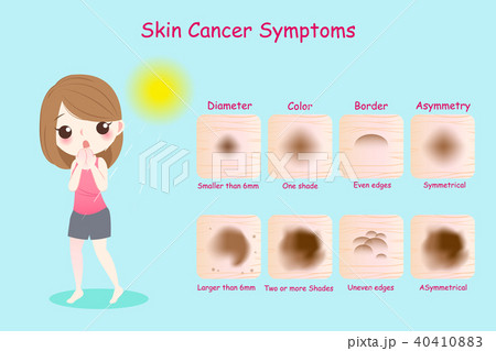 woman with skin cancer symptoms 40410883