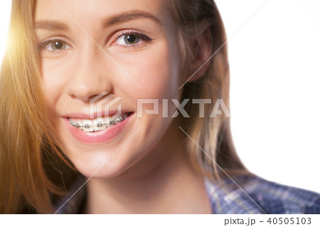 Portrait of teen girl showing dental braces. Portrait of teen girl showing dental braces. 40505103