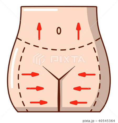 Hips liposuction icon, cartoon style. 40545364