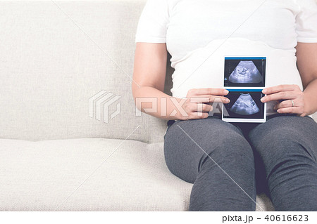 Pregnant woman sitting on sofa holding ultrasound. 40616623
