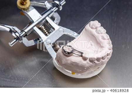 Gray dental prosthesis teeth mold, clay gums model 40618928