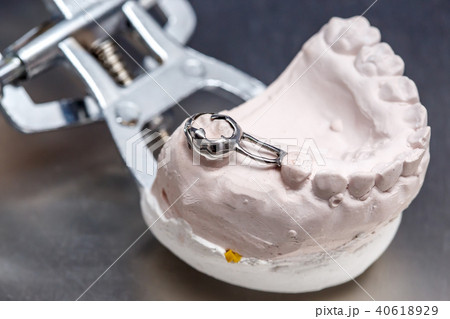 Gray dental prosthesis teeth mold, clay gums model Gray dental prosthesis teeth mold, clay gums model 40618929