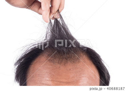 bald head of young man on white background 40688187