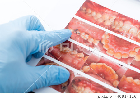 歯科検診 40914116