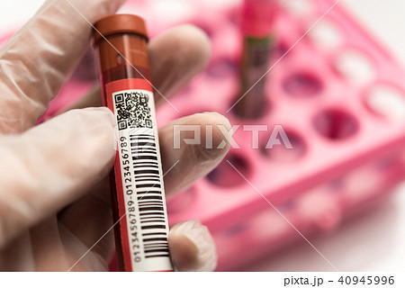 血液検査 40945996