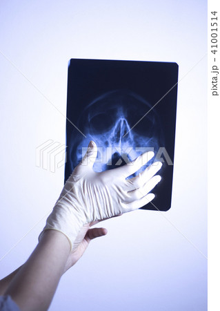 Medical xray face scan 41001514