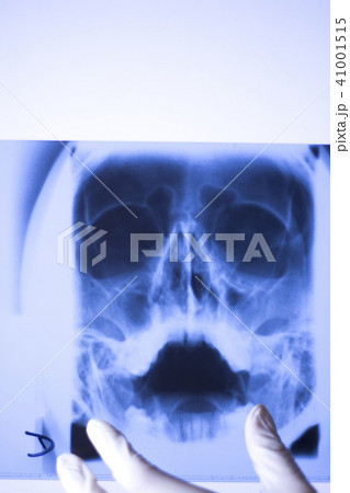 Medical xray face scan 41001515