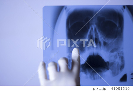 Medical xray face scan Medical xray face scan 41001516