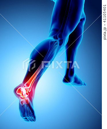 Ankle painful - skeleton x-ray. 41105401