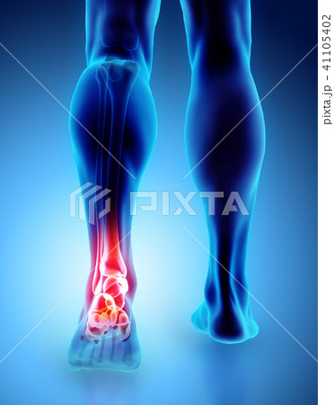 Ankle painful - skeleton x-ray. 41105402