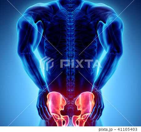 Hip painful skeleton x-ray, 3D illustration. 41105403