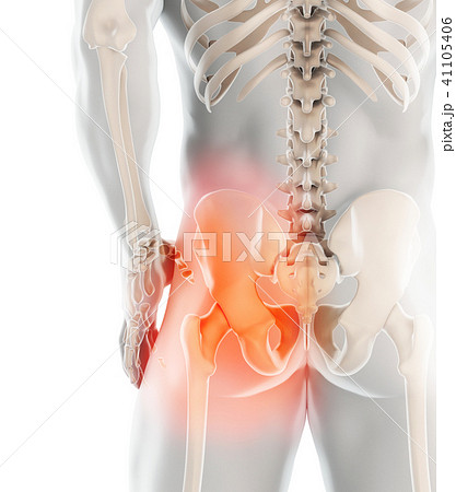 Hip painful skeleton x-ray, 3D illustration. 41105406