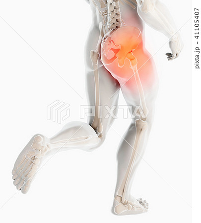 Hip painful skeleton x-ray, 3D illustration. 41105407