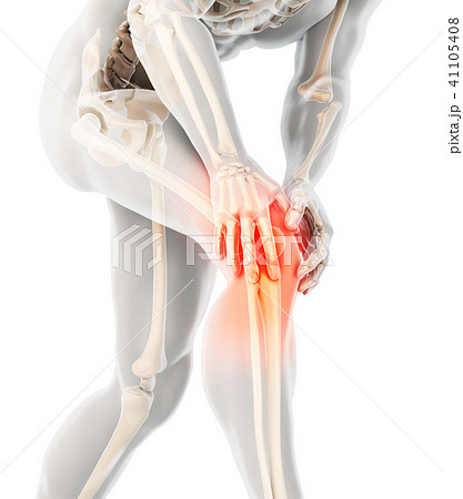 Knee painful - skeleton x-ray. 41105408