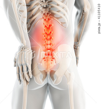 3D Illustration of sacral spine painful. 3D Illustration of sacral spine painful. 41105410