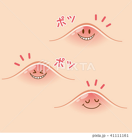 ニキビ　吹き出物 41111161