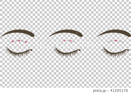 二重手術のイラスト素材 41205178