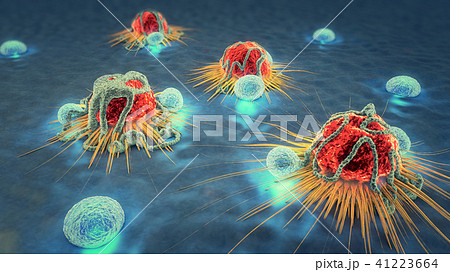 3d illustration of cancer cells and lymphocytes 41223664