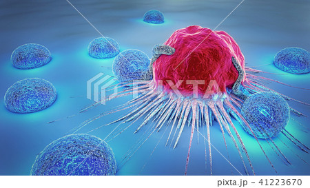 3d illustration of a cancer cell and lymphocytes 41223670