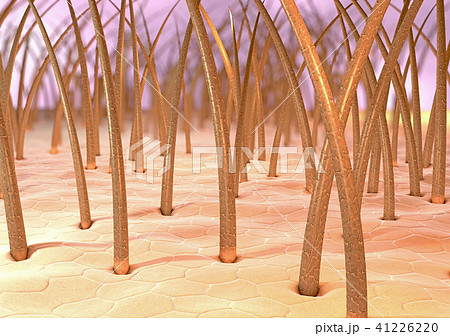 3d illustration of human brittle hair 41226220